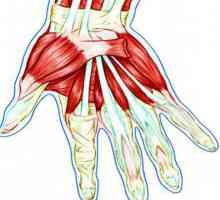 Tetive u ruci: anatomski struktura, upala i oštećenja