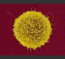 T-pomoćne stanice, što je to? Saznajte što to znači pomoćnih T stanica podignuta ili spuštena