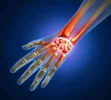 Tenosinovitis od ručni zglob: liječenje, uzroci