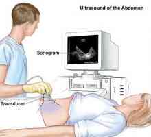 Transabdominalnu ultrazvuk - što je to? Transabdominalnu prsni ultrazvuk