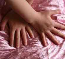 Dijete na prste oblazit kože: uzroci i liječenje