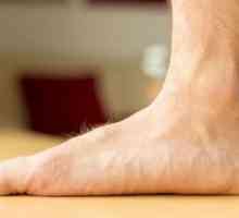 Vježbe za ravnih stopala. Ortopedski ulošci za ravne noge