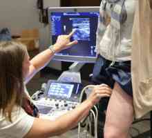 Dopler ultrazvuk donjih udova: taktike studija. Indikacije za postupak