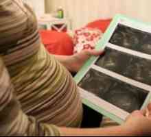 Ultrazvuk u 12 tjedana trudnoće: Fetalni pravila razvoj