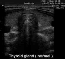 Ultrazvuk štitnjače - normom. Dimenzije štitnjače - norma. Pokazatelji tiroidnih hormona - norma