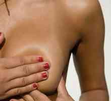 Nodularni dojke dojke: uzroci, simptomi i liječenje