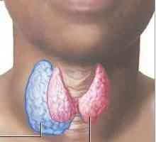 Nodularni gušavost štitne žlijezde: uzroci, simptomi i tretmani