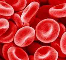 U analizi krvi RDW podiže ili spušta - što to znači?