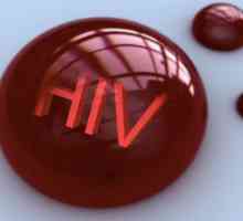 HIV: stadij bolesti