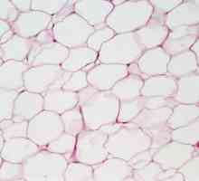 Vrste epitelnog tkiva. Epitelnog tkiva: struktura i funkcija