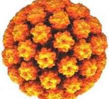 Ljudski virus papiloma: simptomi, načini zaraze, dijagnostiku i liječenje