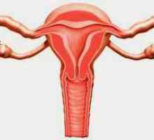 Jajnika upala: simptomi i tretman za žene, uzroci, dijagnoza