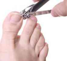 Urastanje noktiju na nogama: uzroci i tretmani