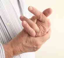 Dislocirani prst na ruci, opis i karakteristike liječenja