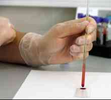 Zašto moram da se test krvi za hormona štitnjače?