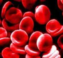 Zašto trebam znati identifikaciju krvna grupa?