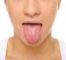Žuta jezik za oblaganje: uzroci i liječenje