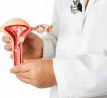 Ženske bolesti. Kako se postupa s ciste jajnika?