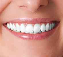 Zubni implantati: pro i kontra. Zubni implantati: cijena, recenzije