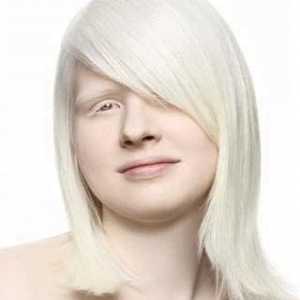 Albinos - i ... albinizam - prirođene odsustvo pigmenta melanina