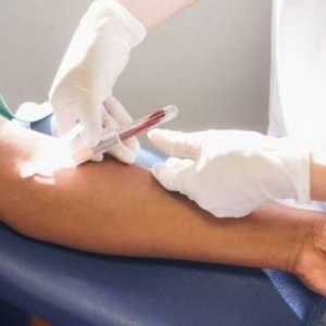 Test krvi za hepatitis
