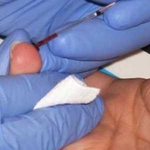 Analiza OVK i druge vrste krvnih pretraga