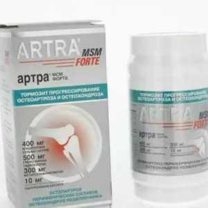 "Artra msm Forte": upute i povratne informacije