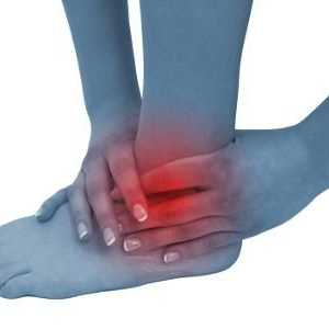 Bolesti koje utječu na gležanj zglobova: artritis