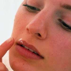 Liječiti hladno čireve na usnama?