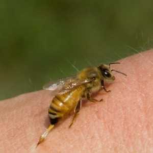 Što učiniti kada je pčelinji ubod? prve pomoći