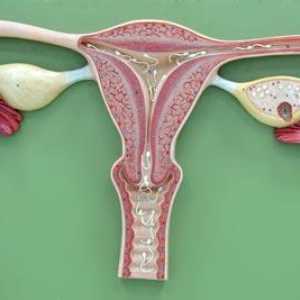 Dijagnoza „endometrioze”: simptomi i liječenje bolesti