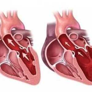 Dijastolički disfunkcija lijeve klijetke srca. Opis. liječenje