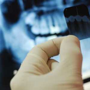 Dokumenti o porezne olakšice za liječenje zuba. Porezne olakšice implantacija zuba