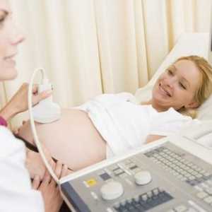 Ispitivanje Doplerography tijekom trudnoće