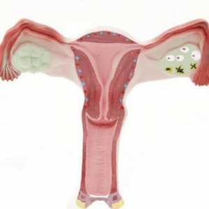Dvostruka ovulacija: uzroci i simptomi