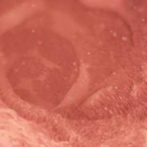 Gdje pronaći odgovor na pitanje koji je dan ovulacija se događa?