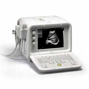 Gdje ultrazvuk? Izbor bolnici