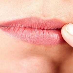 Heilitis na usnama: vrste, uzroci i liječenje
