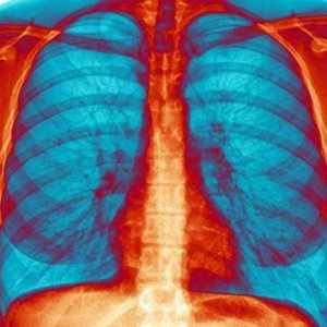 Udisanje bronhitis: ne samo da je moguće, ali je potrebno!
