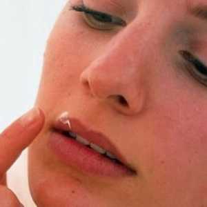 Kako da biste dobili osloboditi od hladnoće na usnama: popis najučinkovitijih metoda