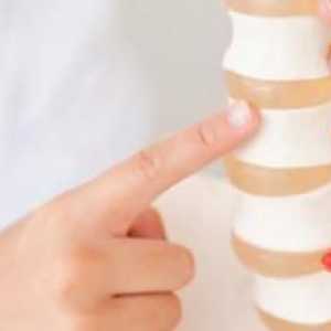 Kako liječiti osteochondrosis vratne kralježnice. Osteochondrosis od vratne kralježnice: liječenje…