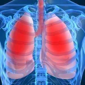 Kako liječiti upalu pluća? korisni savjeti