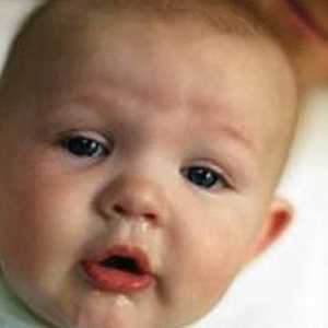 Kako liječiti curenje iz nosa u novorođenčeta?