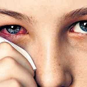 Kako liječiti curi oko?