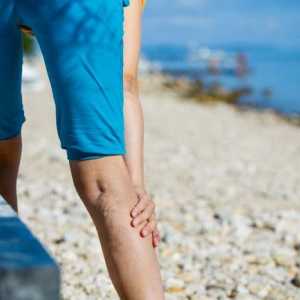 Kako liječiti proširene vene na nogama od muškaraca? Stručni savjet, narodnih lijekova