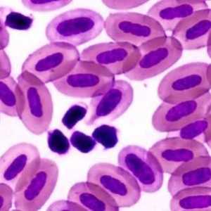 Kako poboljšati sadržaj bijelih krvnih stanica