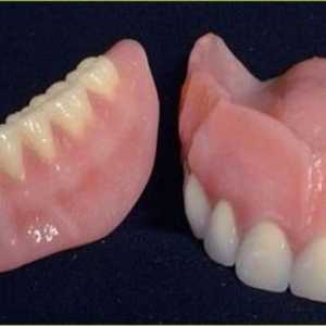 Kako je zubna proteza?