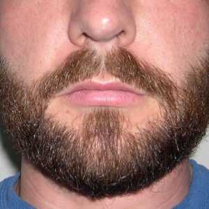 Kako ubrzati rast brade? Savjet Umjesto