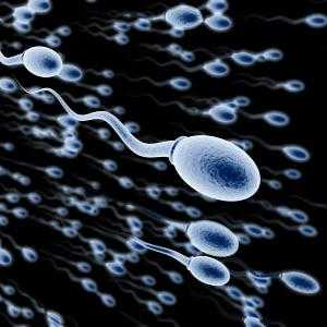 Što bi trebao biti spermija, a što su faktori negativno utječu na nju