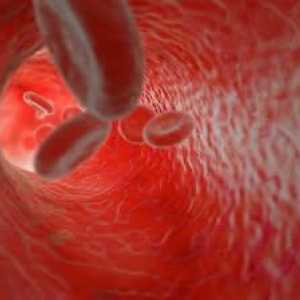 Kapilarna krvarenja: što je to i kako ga zaustaviti